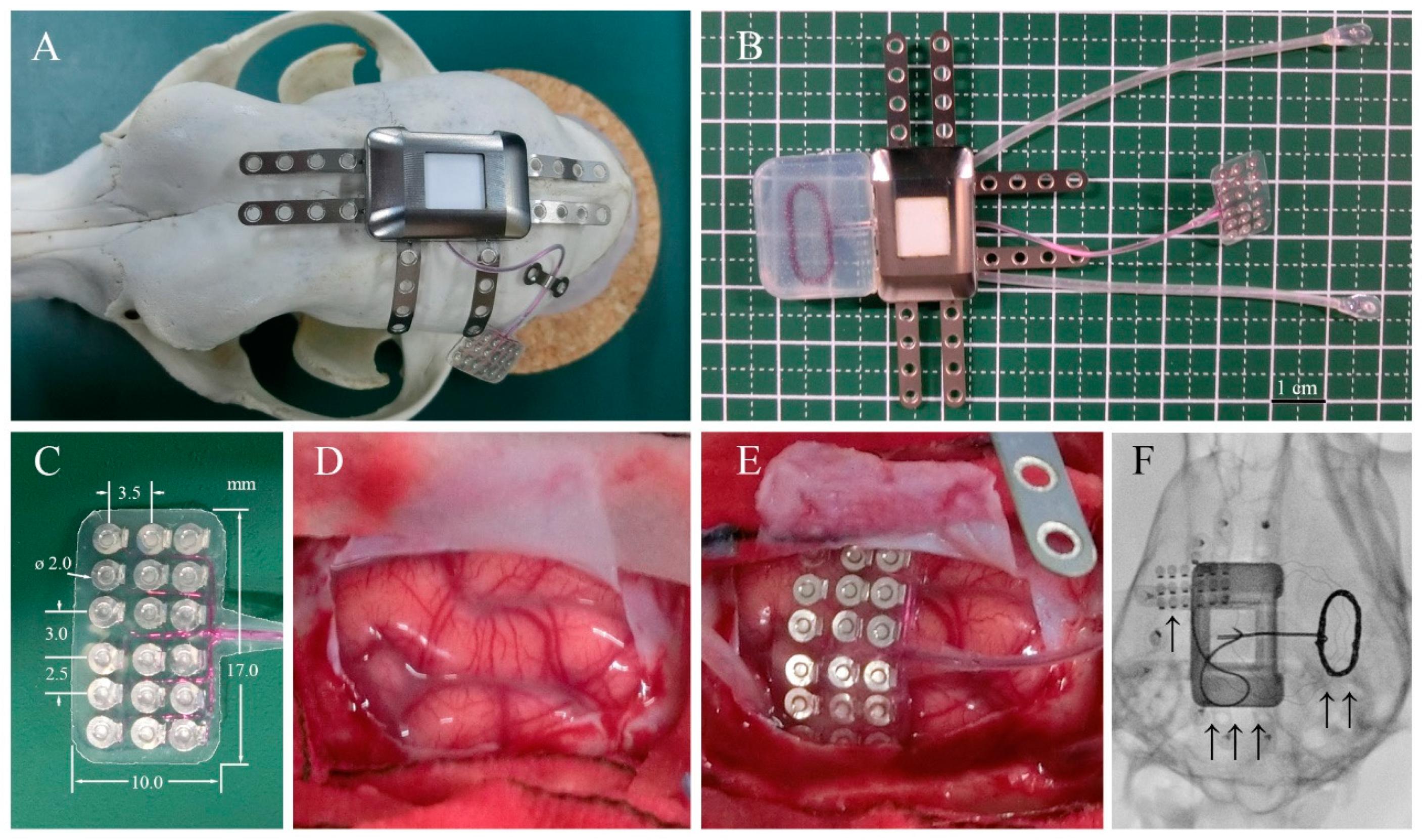 Sensors | Free Full-Text | Minimal Tissue Reaction after Chronic ...
